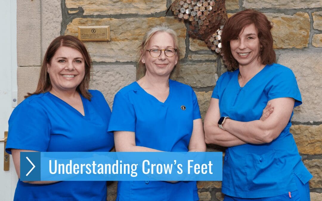 Understanding Crow’s Feet