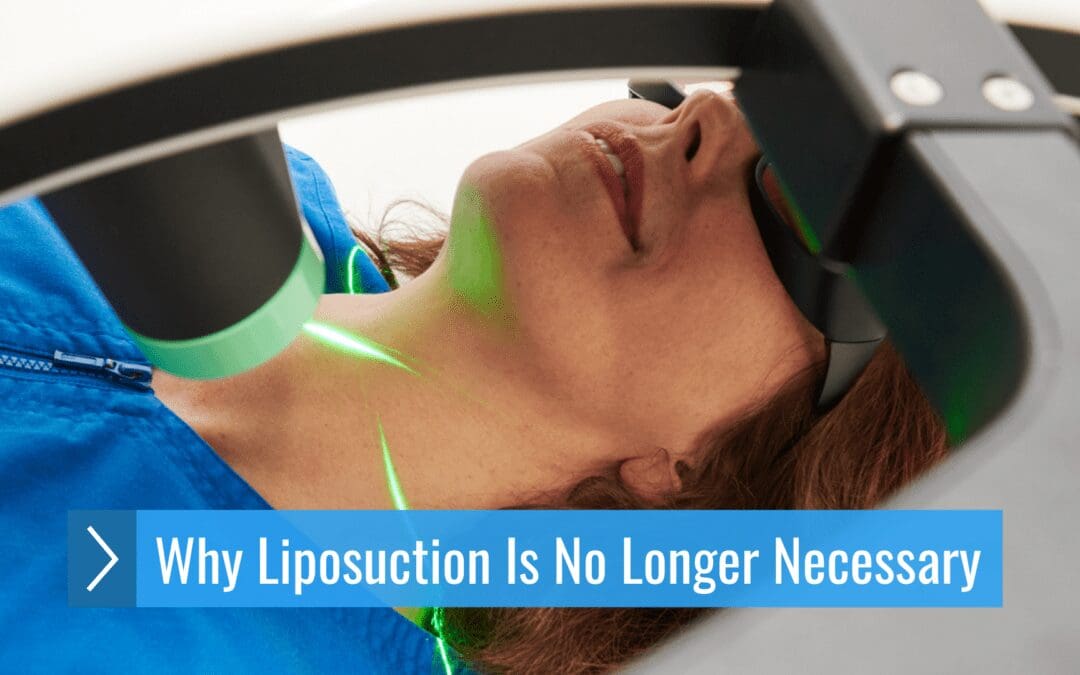 The Weighting Game: Why Liposuction Is No Longer Necessary