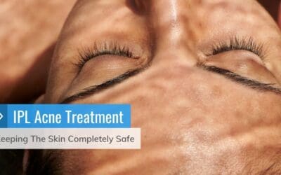 IPL Acne Treatment – Keeping The Skin Completely Safe