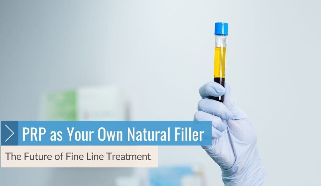 The Future of Fine Line Treatment: PRP as Your Own Natural Filler