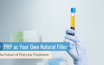 The Future of Fine Line Treatment: PRP as Your Own Natural Filler