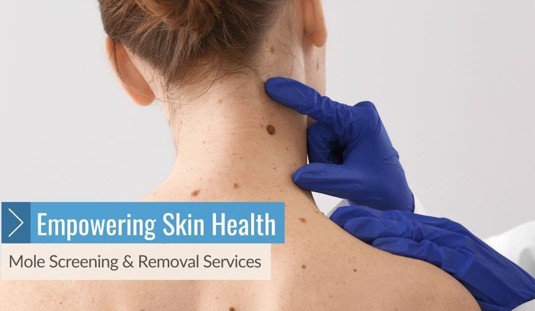 Empowering Skin Health: Mole Screening & Removal Services