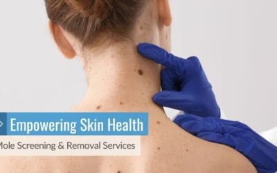 Empowering Skin Health: Mole Screening & Removal Services