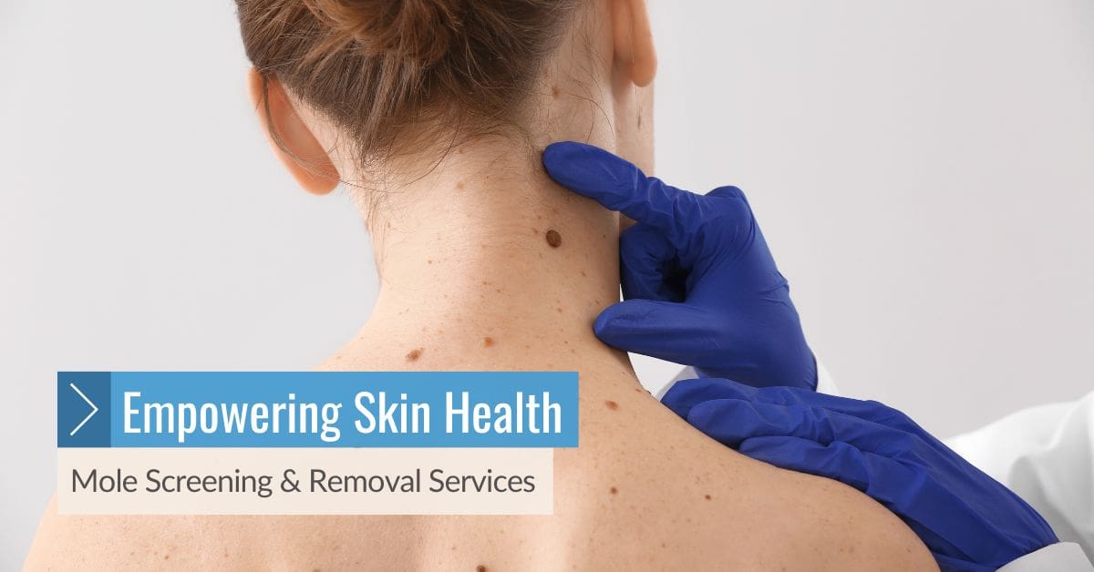 Mole Screening & Removal Services No4 Clinic in Elgin, Moray, Scotland