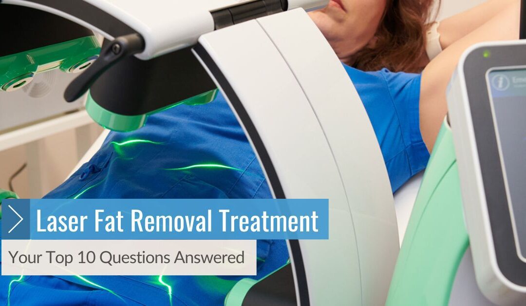 Laser Fat Removal Treatment Your Top 10 Questions Answered