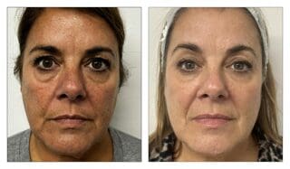 Is Your Skin Thirsty? Why We Love Skinvive (and Why Gael Does Too!)